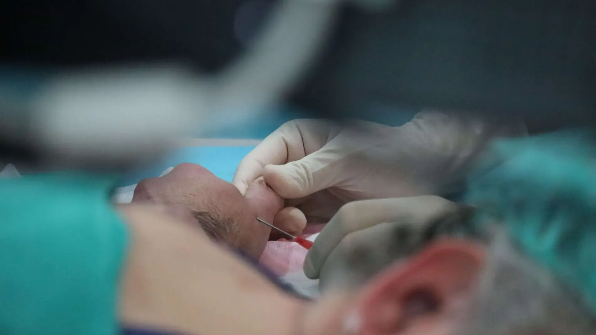 La articulación que une dedo pulgar con muñeca puede desgastarse de forma precoz por sobreúso