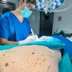 Intervención quirúrgica en el Hospital Virgen Macarena de Sevilla de un melanoma