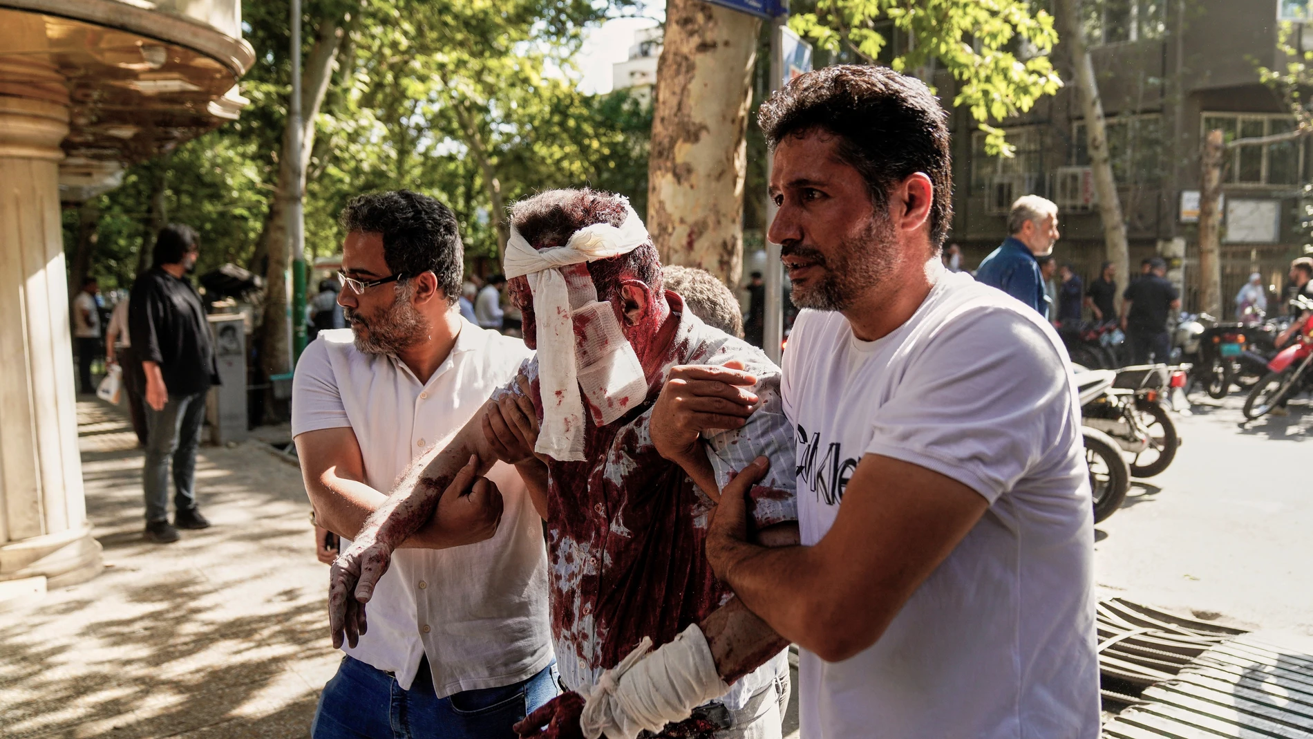 An injured man is helped to leave the scene after an explosion in downtown Tehran, amid Israel's two-day campaign of strikes against Iran, Sunday, June 15, 2025. (AP Photo/Amir Kholousi/ISNA)