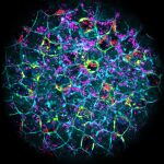 Descubren que los embriones pueden eliminar infecciones bacterianas antes de formar su sistema inmune y abre la puerta a evitar malformacionesrta 
