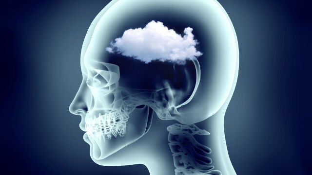 Migrañas, ¿son más frecuentes en verano?