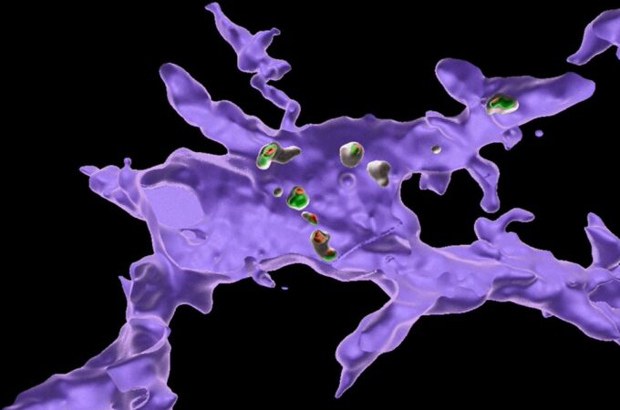 Reconstrucción en 3D de una célula inmunitaria cerebral (morada) que envuelve fragmentos de otras células cerebrales (verde y naranja) tras una dieta rica en sal