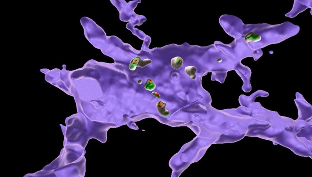 Reconstrucción en 3D de una célula inmunitaria cerebral (morada) que envuelve fragmentos de otras células cerebrales (verde y naranja) tras una dieta rica en sal