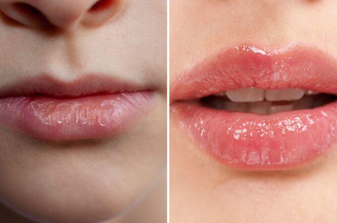 El método definitivo para que tus labios recuperen suavidad y digan adiós a las grietas
