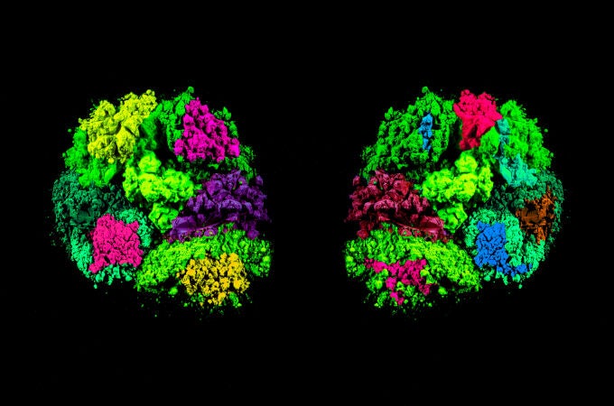 Ilustración del cerebro con foco en el tálamo, región implicada en el autismo y la epilepsia