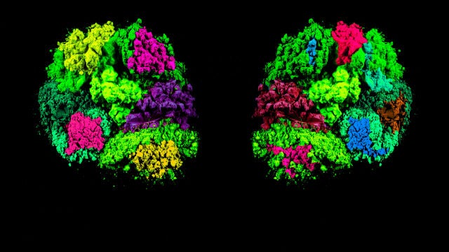 Ilustración del cerebro con foco en el tálamo, región implicada en el autismo y la epilepsia