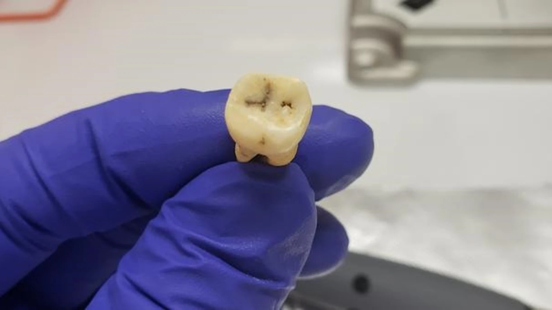 Un investigador sostiene un diente de Jerash utilizado para ayudar a identificar el origen de la primera pandemia