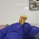 Uno de los dientes del que se obtuvo ADN con pruebas de la bacteria culplable de la pandemia