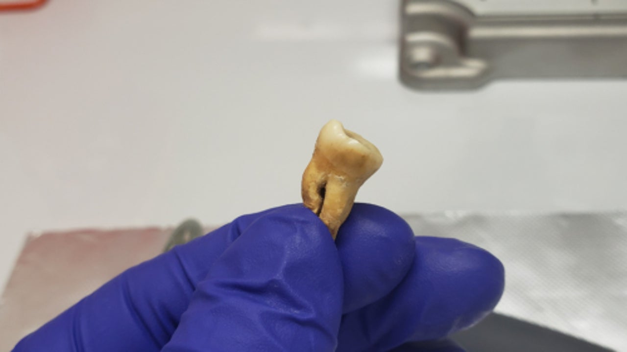 El ADN permite descubrir el origen de la primera pandemia