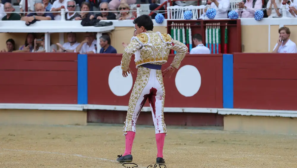 Tremendo sangrado de la herida