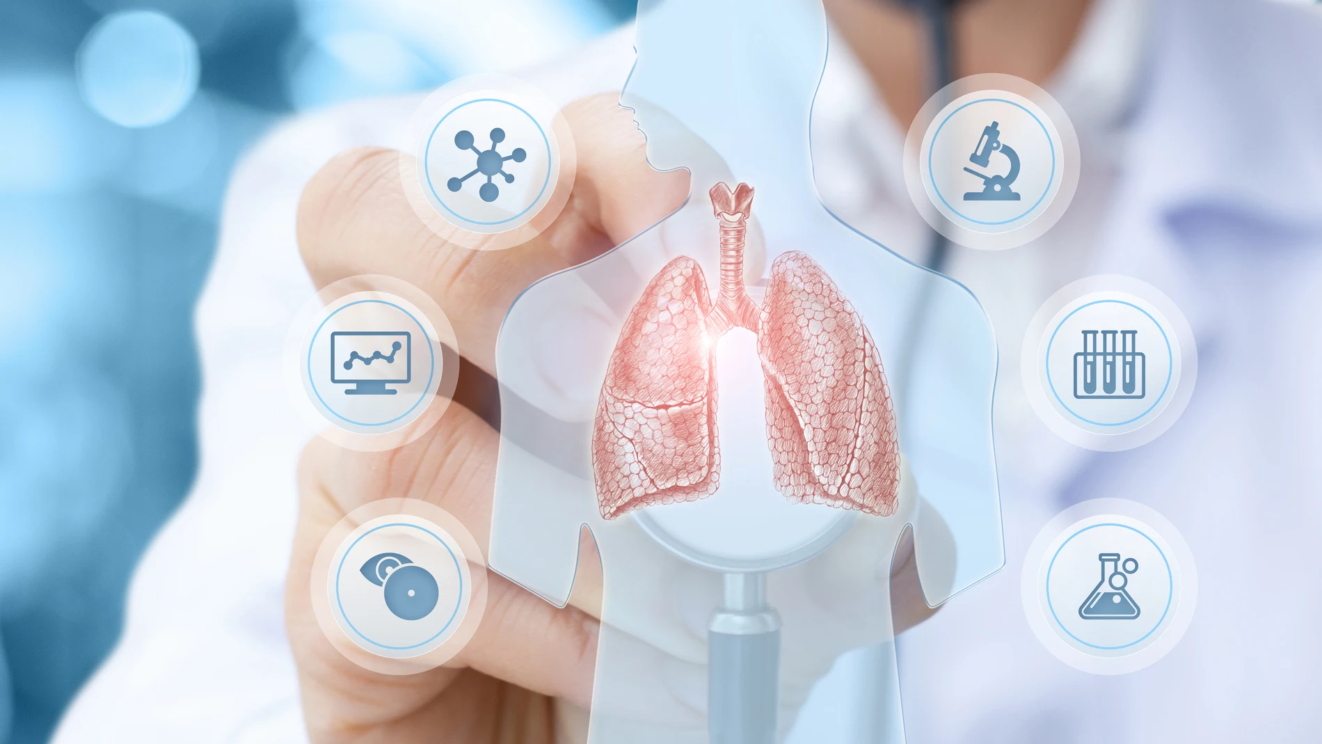 El cáncer de pulmón no microcítico (CPNM) avanzado se presenta una incidencia de más de 2.100 casos anuales