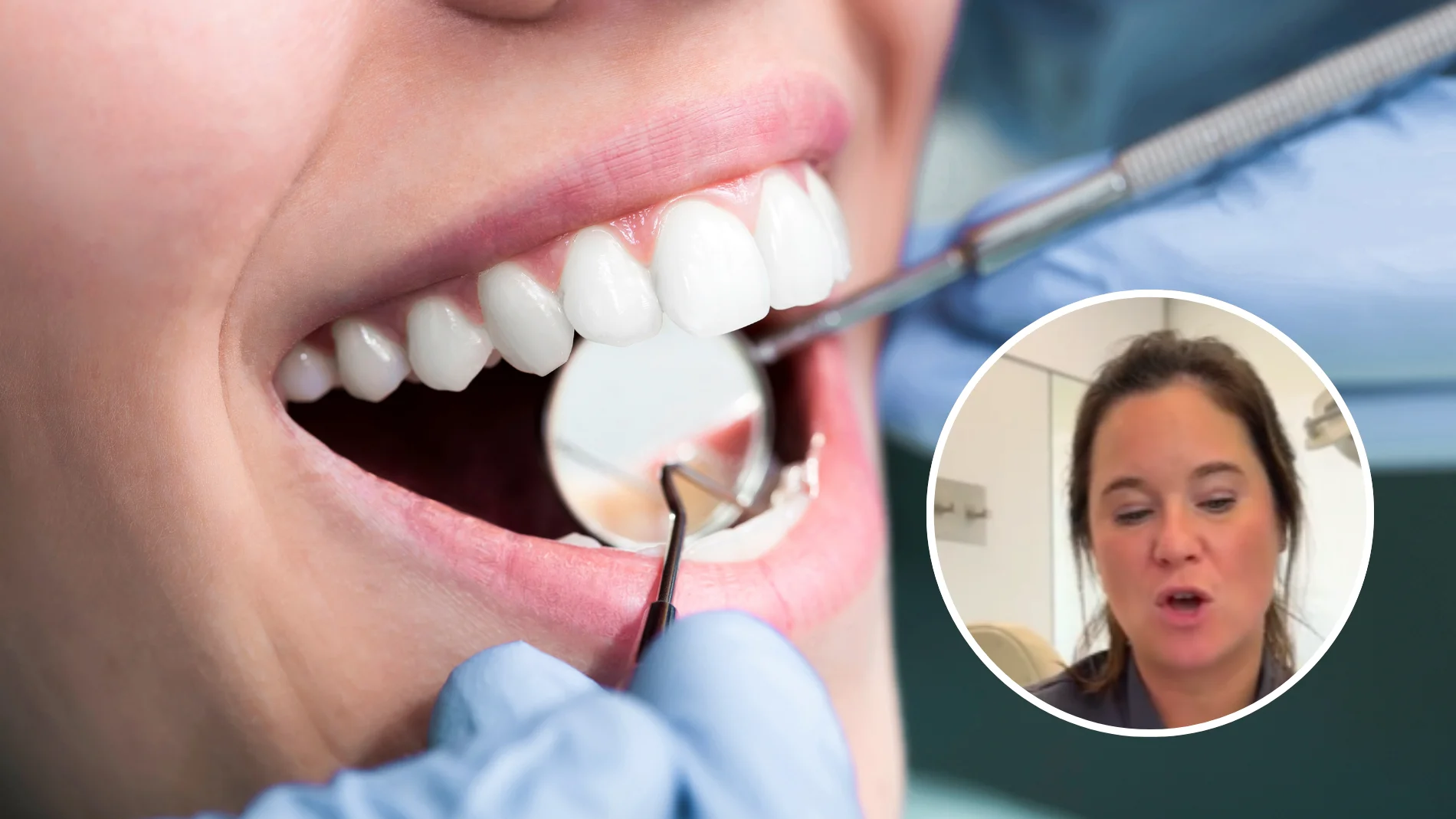 Una dentista desmiente uno de los grandes mitos de la salud bucodental: "Tener los dientes amarillos no quiere decir que tengas mala higiene"