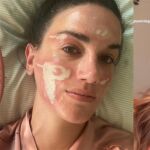 Una mujer acusa a la esteticista de Kim Kardashian, Jennifer López o Madonna: "Me dejó con quemaduras y cicatrices"