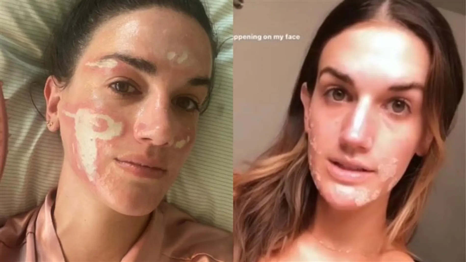 Una mujer acusa a la esteticista de Kim Kardashian, Jennifer López o Madonna: "Me dejó con quemaduras y cicatrices"