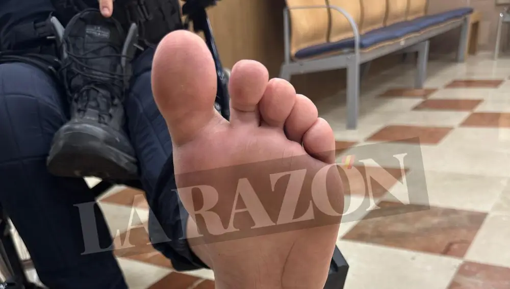 Las heridas de los antidisturbios en los incidentes de la Vuelta en Madrid