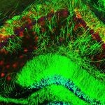 Visualización de los circuitos cerebrales implicados en la depresión