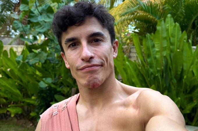 Marc Márquez, con el brazo en cabestrillo