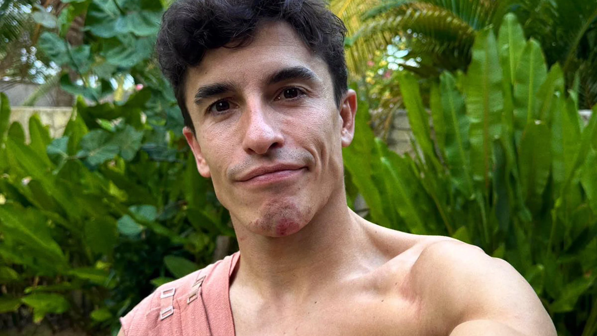 Marc Márquez, con el brazo en cabestrillo