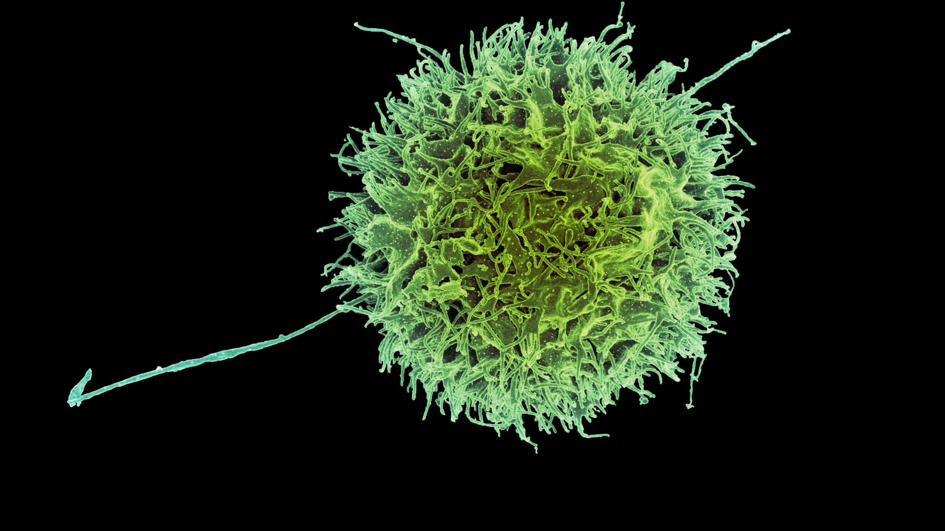 Oncología