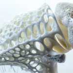 La densidad mineral ósea es más baja de lo normal en la ostopenia, pero sin ser osteoporosis