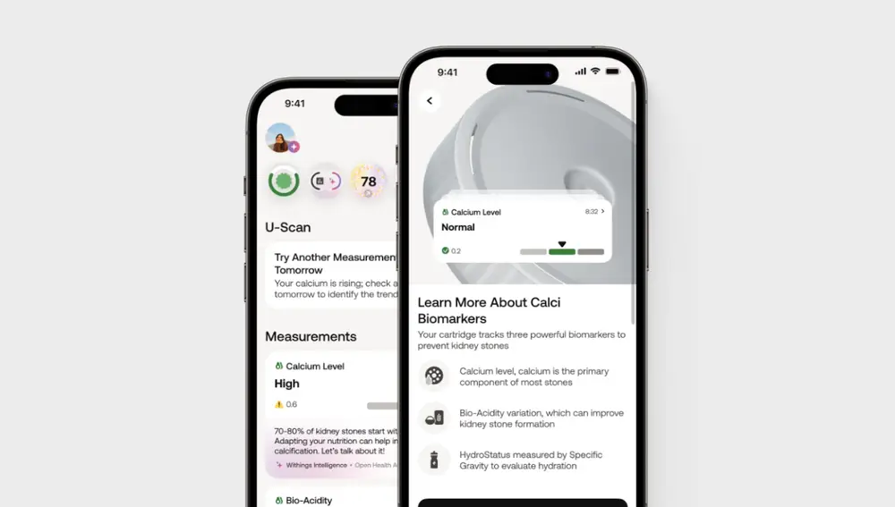 App de Withings para interpretar los resultados.