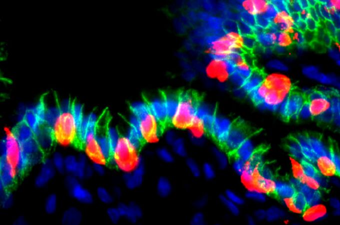 Imagen de las células estomacales modificadas genéticamente Imagen de las células estomacales modificadas genéticamente