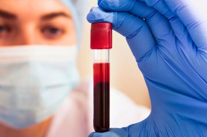 La prueba de sangre que podría cambiarlo todo: detectar múltiples tipos de cáncer años antes de lo habitual
