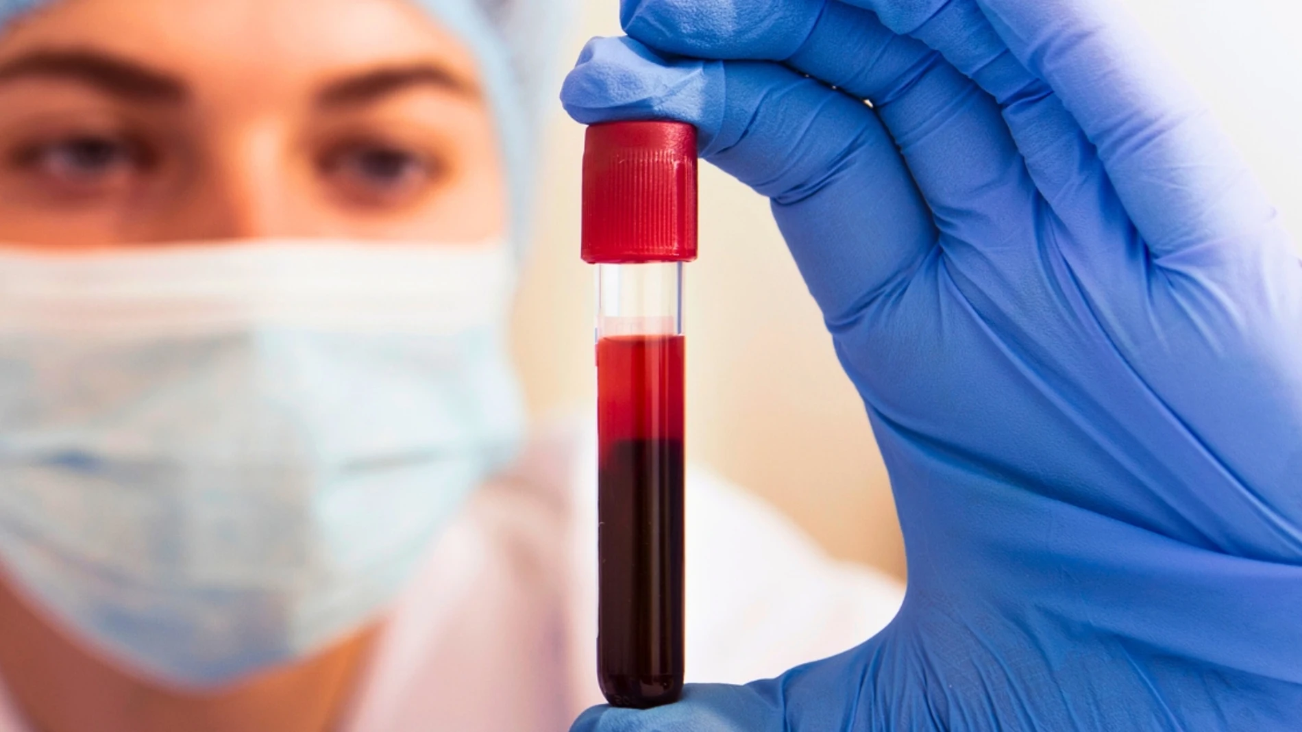 Una nueva investigación publicada en la revista CANCER muestra que una prueba de sangre podría detectar hasta 14 tipos de cáncer en fases tempranas, reduciendo casi a la mitad los diagnósticos avanzados