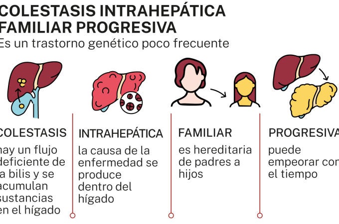 Colestasis intrahepática