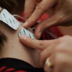 La estimulación eléctrica espinal no es nada invasiva, los pacientes la toleran bien y se hace de forma ambulatoria La estimulación eléctrica espinal no es nada invasiva, los pacientes la toleran bien y se hace de forma ambulatoria