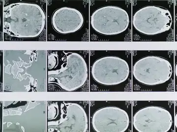 ¿Cómo afecta el frío a tu cerebro? ¿Cómo afecta el frío a tu cerebro?
