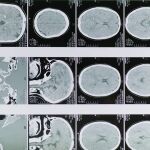 ¿Cómo afecta el frío a tu cerebro? ¿Cómo afecta el frío a tu cerebro?