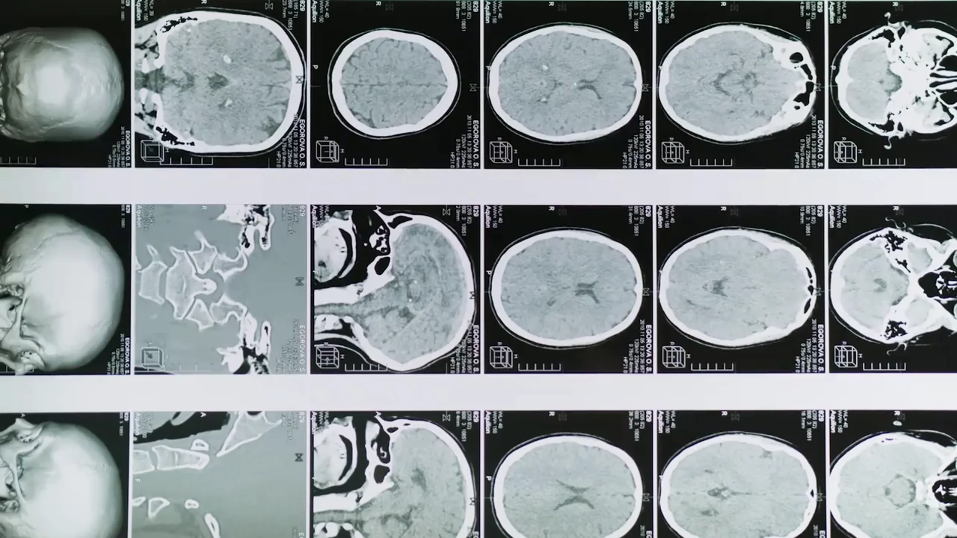 ¿Cómo afecta el frío a tu cerebro?