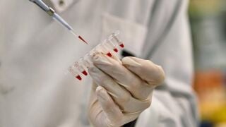 PrimeC, una combinaci&oacute;n de celecoxib y ciprofloxacino, est&aacute; dise&ntilde;ado para combatir la neuroinflamaci&oacute;n