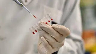 PrimeC, una combinación de celecoxib y ciprofloxacino, está diseñado para combatir la neuroinflamación PrimeC, una combinación de celecoxib y ciprofloxacino, está diseñado para combatir la neuroinflamación