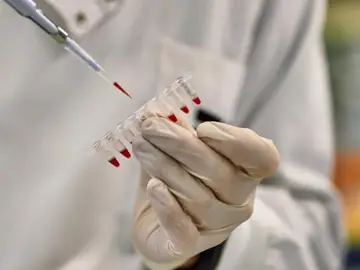 PrimeC, una combinación de celecoxib y ciprofloxacino, está diseñado para combatir la neuroinflamación PrimeC, una combinación de celecoxib y ciprofloxacino, está diseñado para combatir la neuroinflamación