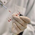 PrimeC, una combinaci&oacute;n de celecoxib y ciprofloxacino, est&aacute; dise&ntilde;ado para combatir la neuroinflamaci&oacute;n