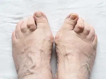 Lo que dicen los dedos de los pies de tu salud: son clave para identificar problemas Lo que dicen los dedos de los pies de tu salud: son clave para identificar problemas