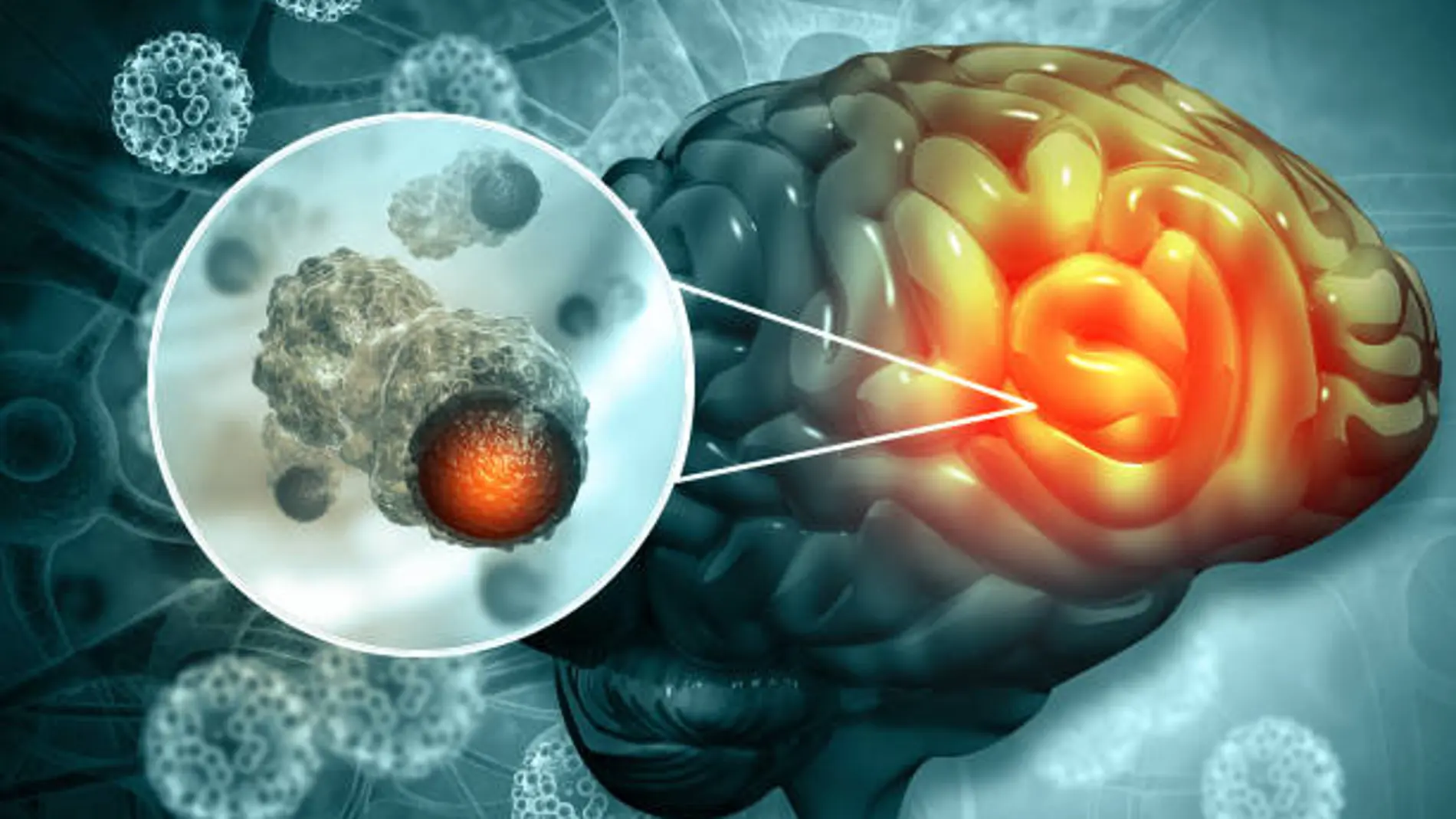 Un fármaco de uso habitual podría ralentizar el tumor cerebral más agresivo