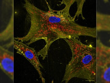  Imagen microsc&oacute;pica que muestra c&oacute;mo las nanoflores (blancas) ayudan a las c&eacute;lulas sanas (amarillas) a transportar mitocondrias productoras de energ&iacute;a (rojas) a las c&eacute;lulas vecinas. Los n&uacute;cleos est&aacute;n te&ntilde;idos de azul.