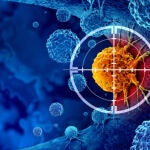 Una nueva terapia explora el uso de c&eacute;lulas grasas para frenar el c&aacute;ncer