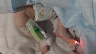 La bebé Isabel R. Balmes fue trasladada desde el Hospital Universitario de Melilla al Hospital de Málaga por falta de recursos en Melilla