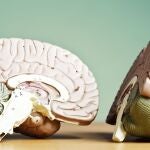 Cient&iacute;ficos advierten sobre un hallazgo clave en el cerebro que afecta a toda la poblaci&oacute;n y demandan m&aacute;s estudio