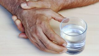 Las manos de un hombre con la enfermedad de Parkinson tiemblan. Las manos de un hombre mayor tiemblan con fuerza.