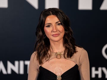 Alexandra Pereira se hace el lifting de las famosas.