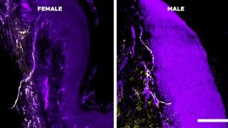 C&eacute;lulas de la piel de un rat&oacute;n hembra (izquierda) y uno macho (derecha) vistas al microscopio. La tinci&oacute;n permite ver en amarillo las concentraciones de interleucina-10 que podr&iacute;a estar inhibiendo el dolor en los machos m&aacute;s que en las hembras.