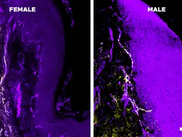 Células de la piel de un ratón hembra (izquierda) y uno macho (derecha) vistas al microscopio. La tinción permite ver en amarillo las concentraciones de interleucina-10 que podría estar inhibiendo el dolor en los machos más que en las hembras. Células de la piel de un ratón hembra (izquierda) y uno macho (derecha) vistas al microscopio. La tinción permite ver en amarillo las concentraciones de interleucina-10 que podría estar inhibiendo el dolor en los machos más que en las hembras.