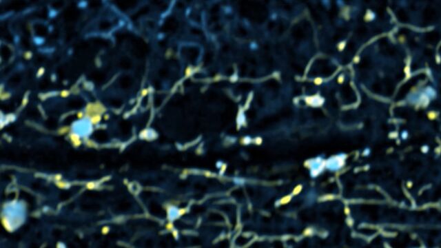Los lisosomas (en amarillo) interact&uacute;an con el ER (en azul) reconfigurando la c&eacute;lula