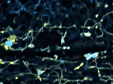 Los lisosomas (en amarillo) interactúan con el ER (en azul) reconfigurando la célula Envejecimiento