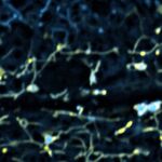 Los lisosomas (en amarillo) interact&uacute;an con el ER (en azul) reconfigurando la c&eacute;lula